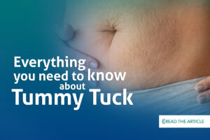 Read more about the article Everything You Need to Know About the Tummy Tuck 