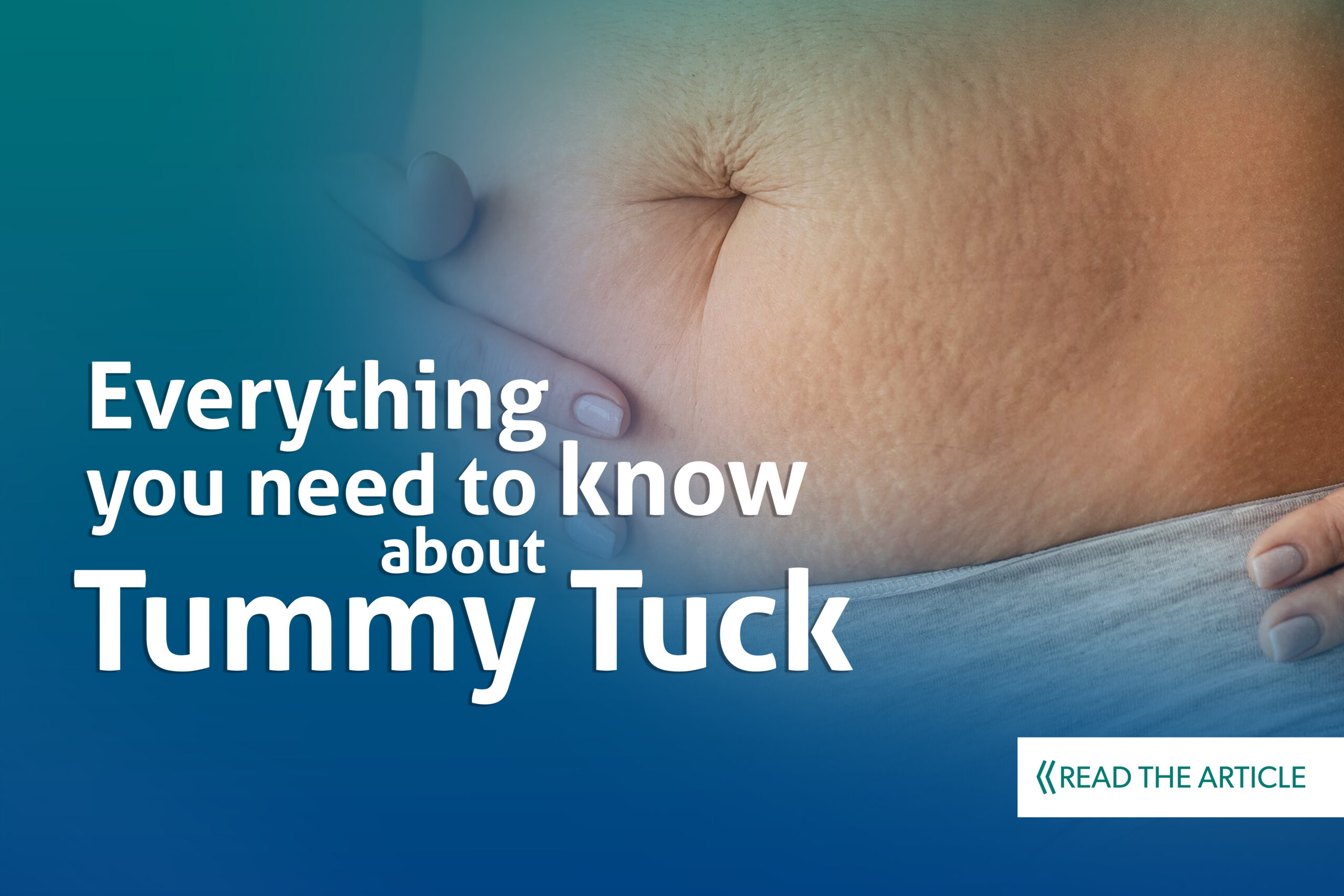 You are currently viewing Everything You Need to Know About the Tummy Tuck 