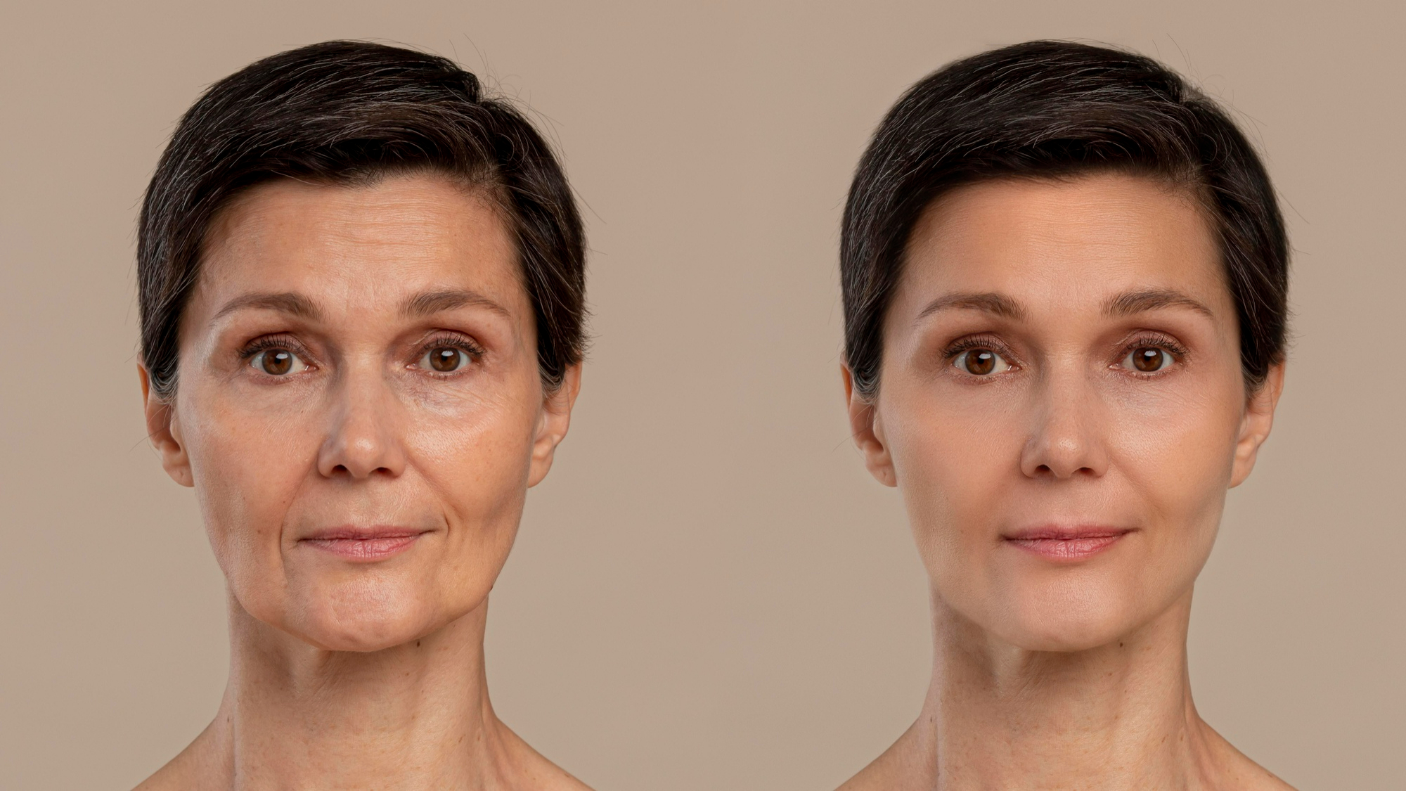You are currently viewing Everything you need to know about Facelift Surgery