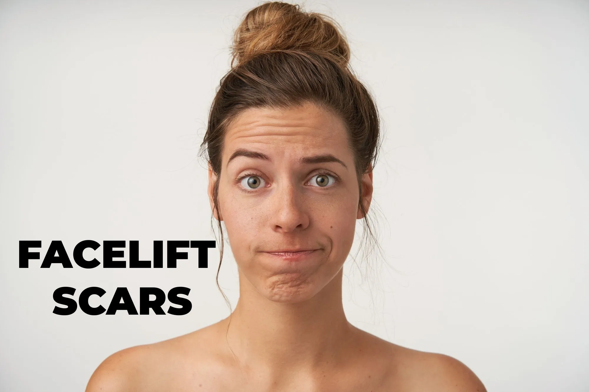 You are currently viewing Facelift Scars: Achieving a Youthful Look with Minimal Scarring