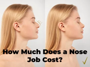 Read more about the article How Much Does a Nose Job Cost?