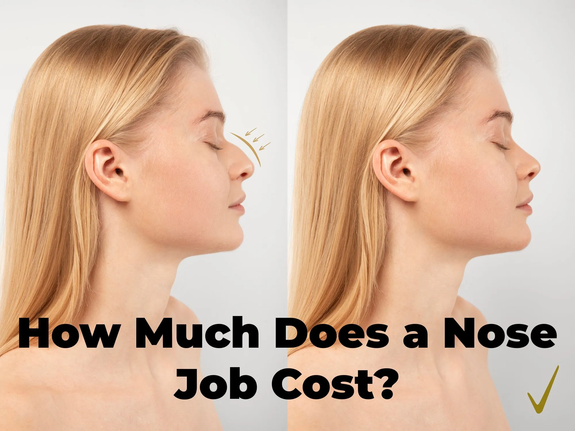 Read more about the article How Much Does a Nose Job Cost?