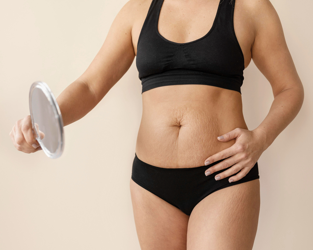 Read more about the article The Best Tummy Tuck in Mexico