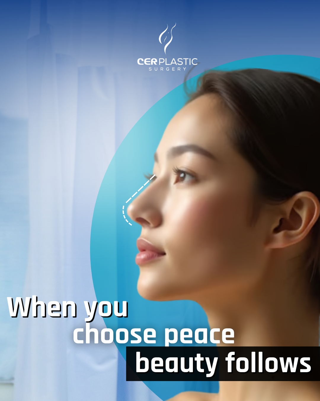 rhinoplasty ad