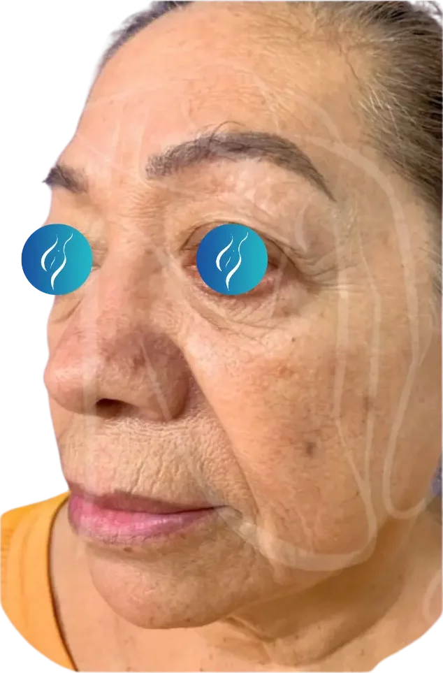 Before, example case