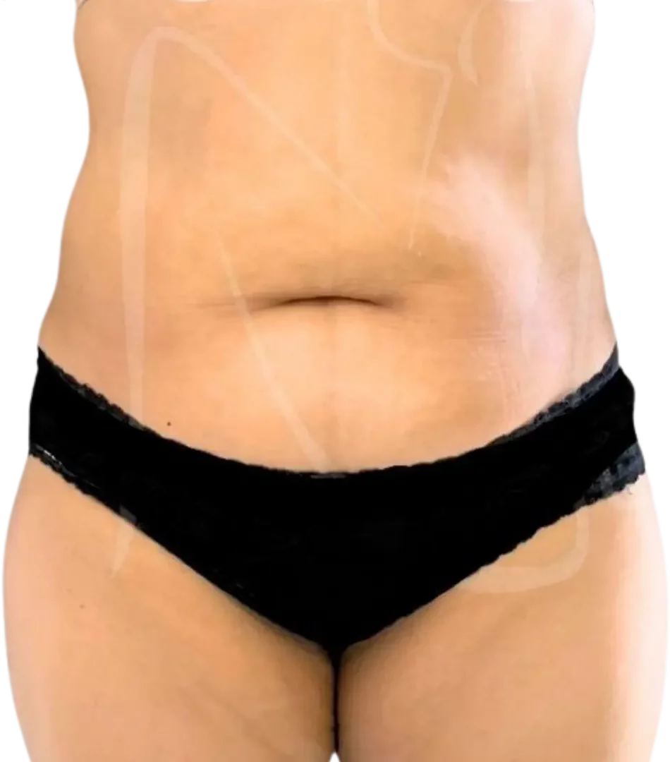 Before, example case